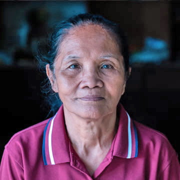 Corazon, a SEE patient from the Philippines 